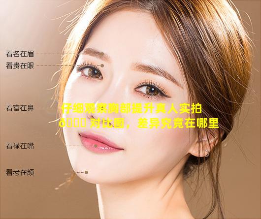 仔细观察胸部提升真人实拍 🐒 对比图，差异究竟在哪里
